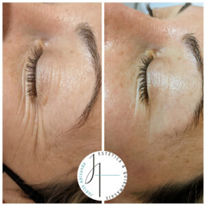 Centro de Estética en Zaragoza Judith Abizanda