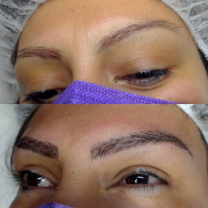 Nefertiti Estética Avanzada