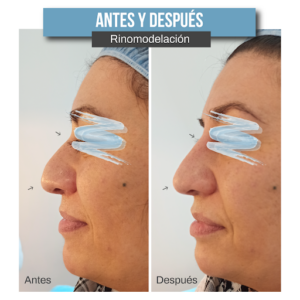 Clínicas DH - Zaragoza Medicina Estética & Depilación Láser
