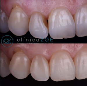 Clínica Dental ZOE - Zaragoza Odontología Especializada