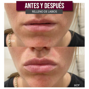 Clínicas DH - Zaragoza Medicina Estética & Depilación Láser