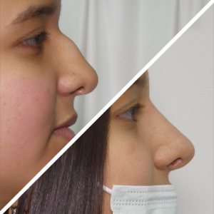 Clínicas DH - Zaragoza Medicina Estética & Depilación Láser