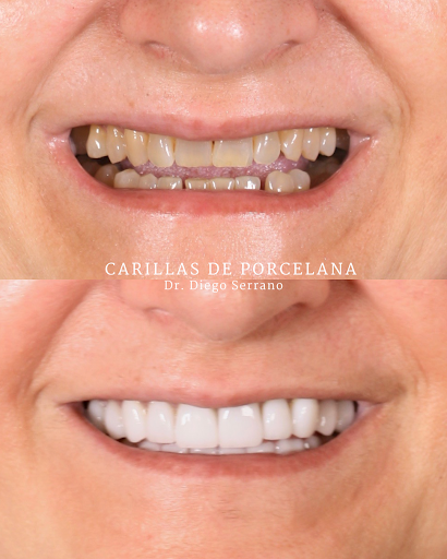 Clínica Dental San Lorenzo