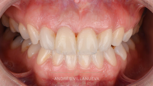 Iberdent Clínica Dental - Dres. Villanueva