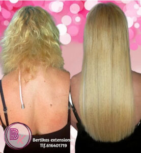 Bertikas extensiones