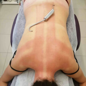 NM - Natalia Muñoz - Fisioterapia