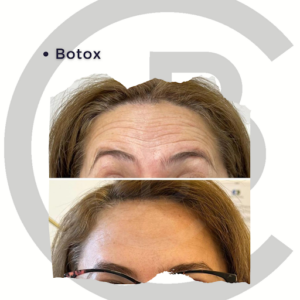 Clínica CJB MEDICAL . Centro De Medicina Estética en el Centro De Zaragoza.